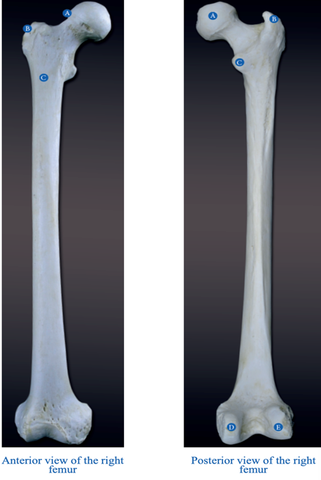 <p>D</p>