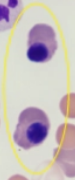 <p>what is it (Abnormalities)</p>