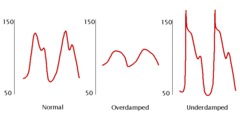 <p>-dicrotic notch on the downslope</p><p>-overdampened: air bubbles, blood clots, kinked tubing, loose connections</p><p>-underdampened:excessive tubing length or too many stopcocks</p>