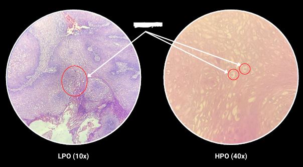 <p>What are the arrows pointing?</p>