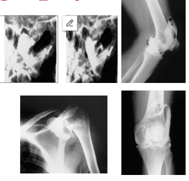 <p>Arthrography</p>
