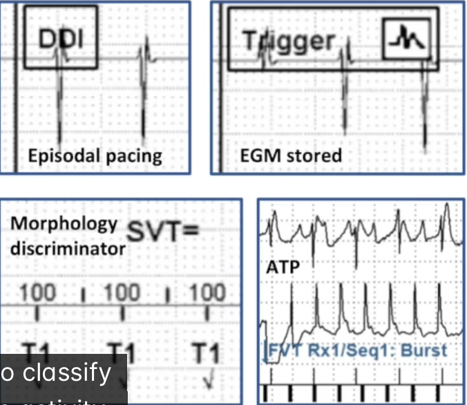 <p><strong>Classify device activity</strong></p><ul><li><p>Algorithms (mode switch)</p></li><li><p>VT/VF detected</p></li><li><p>Clinical or induced</p></li><li><p>Discriminators</p></li><li><p>Episodal pacing</p></li><li><p>Therapy delivery</p></li><li><p>Charge delivered/aborted</p></li><li><p>EGM stored</p></li></ul><p></p>