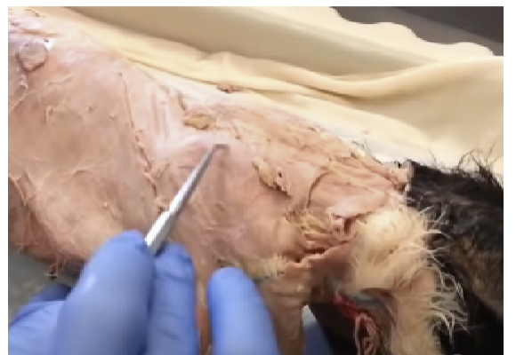 <p>Adducts the scapula</p>