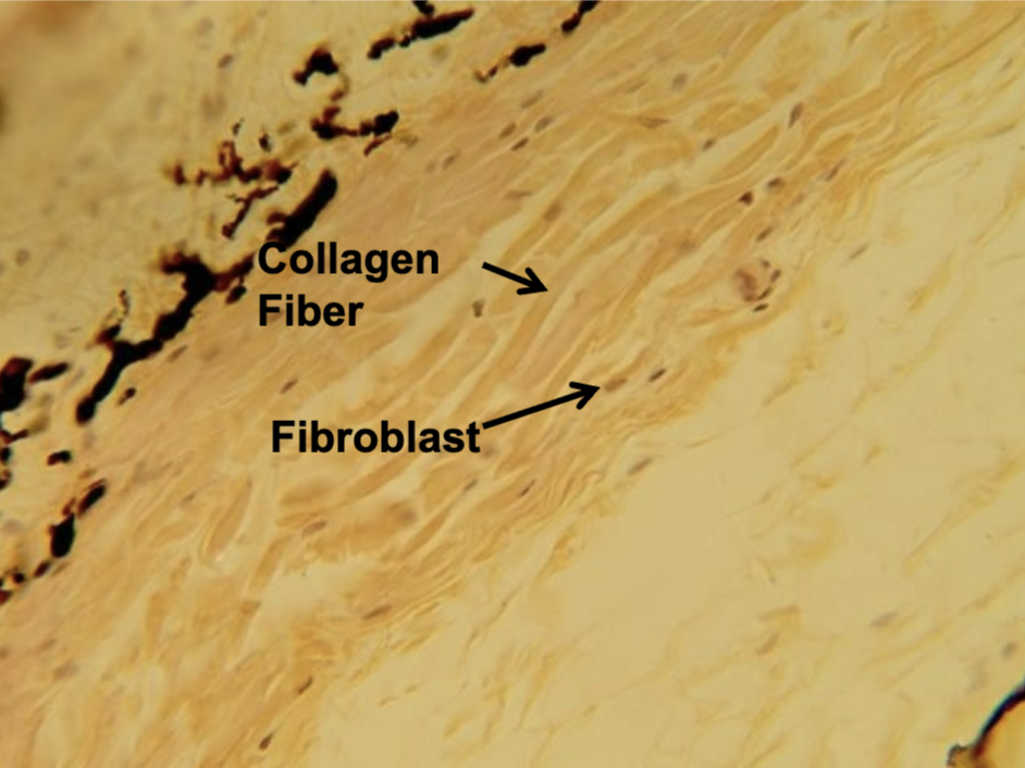 <p>What connective tissue is this?</p>