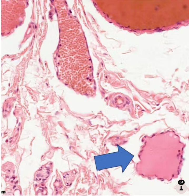 <p>Identify the vessel</p>