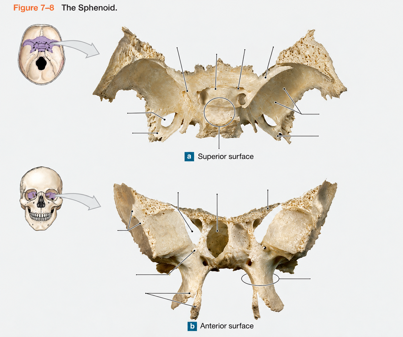 <p>Name the Bones (10) </p>