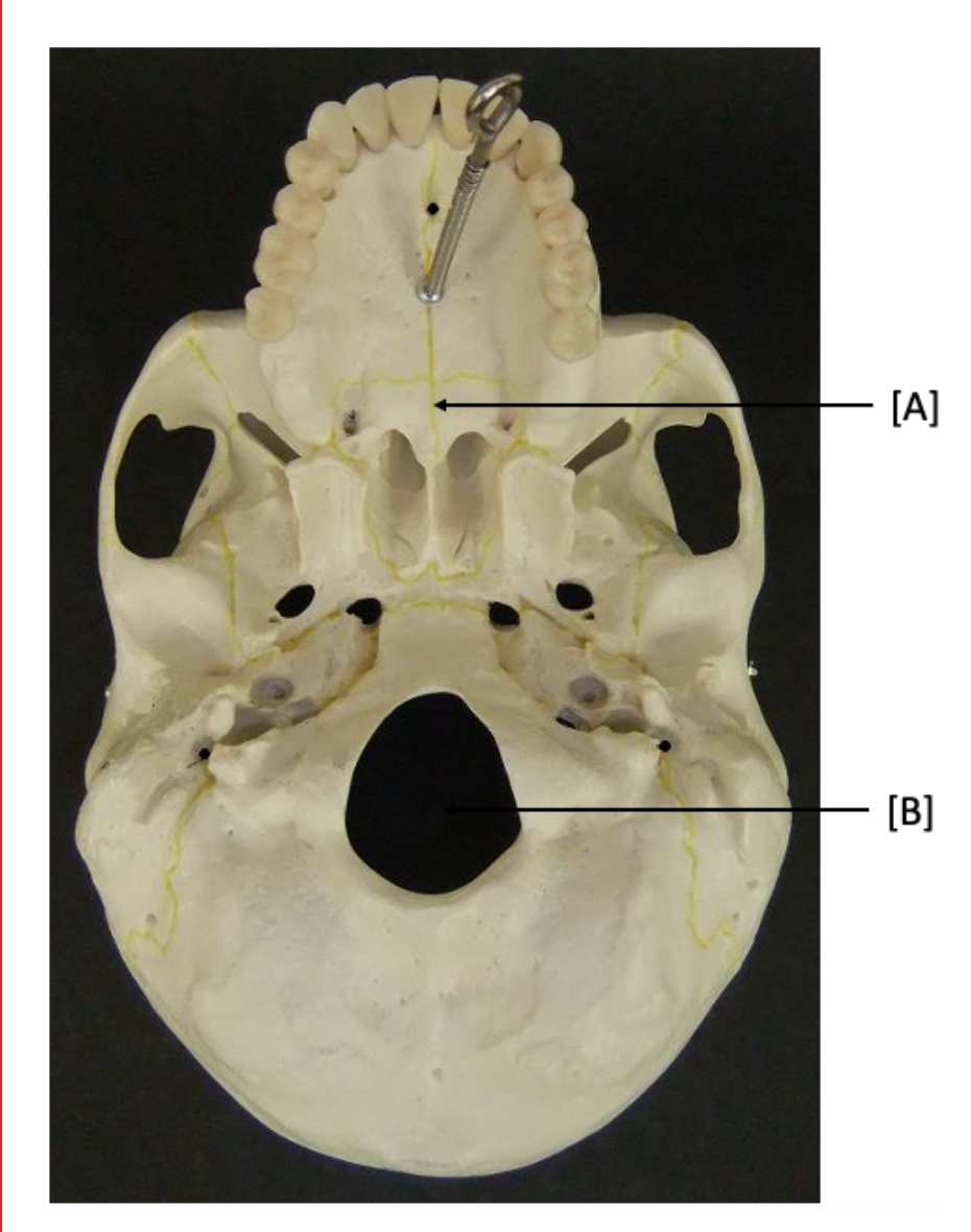 <p>A Bone</p>