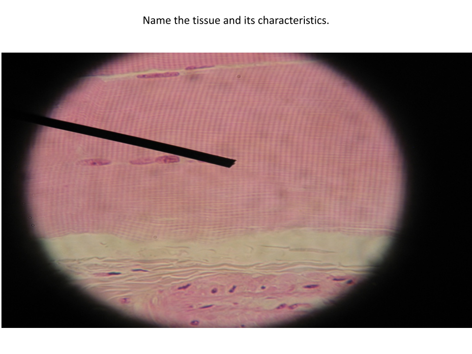 <p>Characteristics of this tissue?</p>