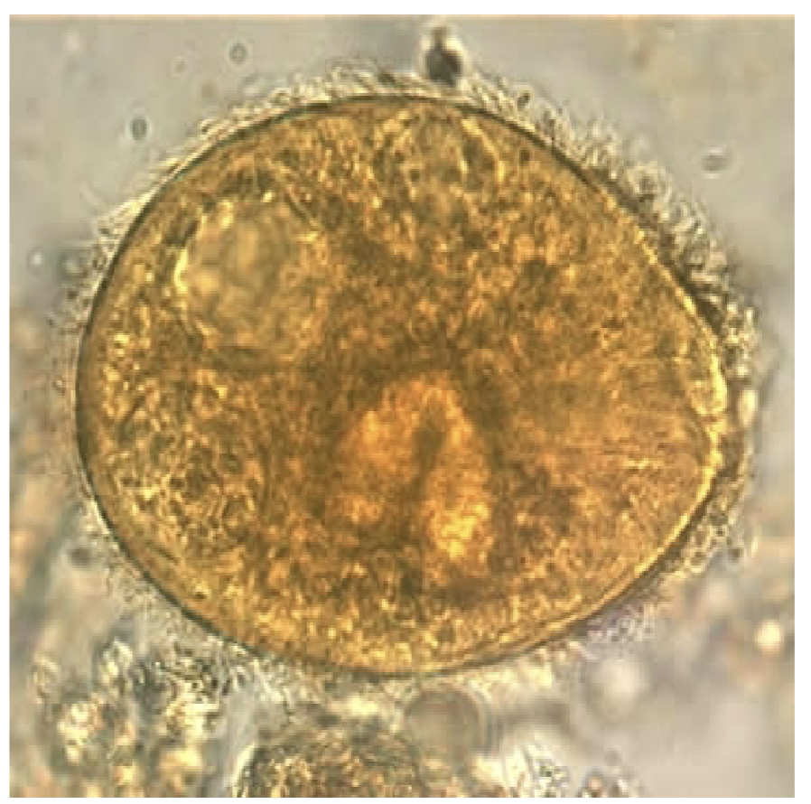 <p>-Cyst</p><ul><li><p>Infrequently seen</p></li></ul><p>-Trophozoite</p><ul><li><p>Large, up to 200 microns</p></li><li><p>Cytostome and cilia</p></li></ul><p></p>