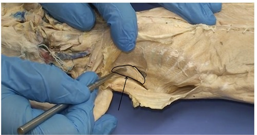 <p>What muscle is this?</p>