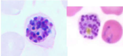 <p>Identifique, identifique seu habitat e cite três sintomas característicos da doença</p>