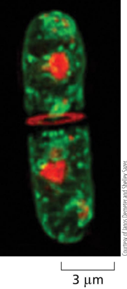 <p>What kind of micrograph is this?</p>