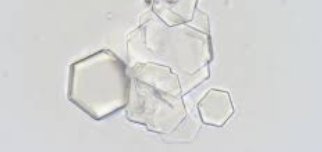 <p>6-sided plates, refractile</p><p>Abnormal, seen with cystinosis/cystinuria </p>