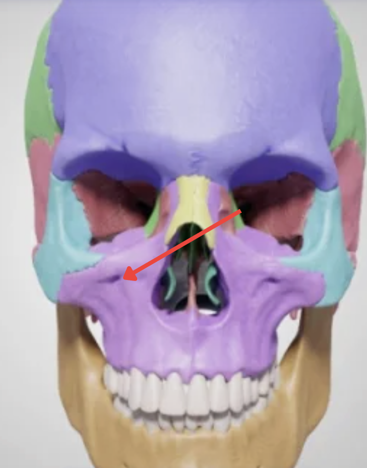 term image