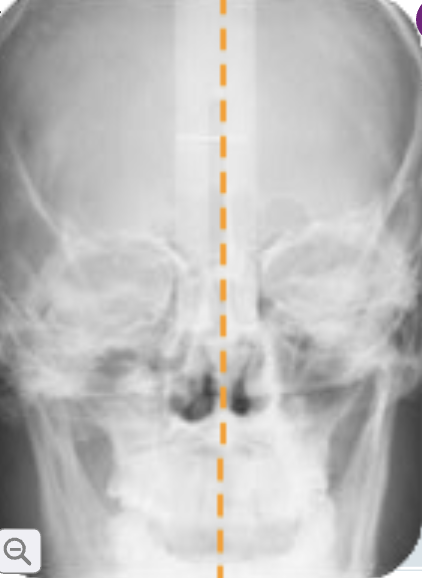 <p>what is the midsagittal plane? </p>