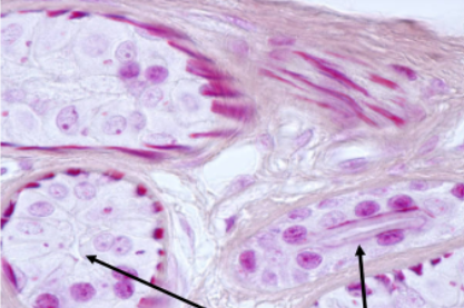 <p>Slide 15</p>