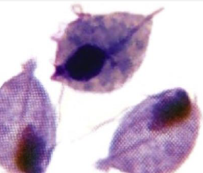 <p>Trichomonads: morphologic characteristics, transmission</p>