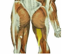 <p>What muscle is the highlighted region depicting? what is its action? </p>