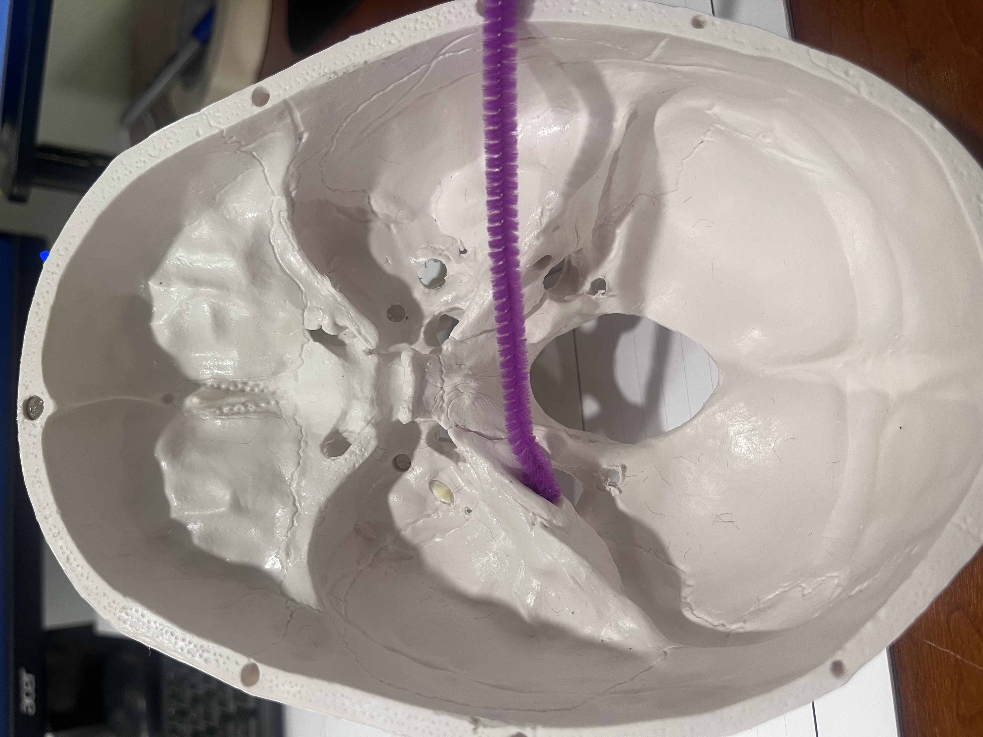 <p>What cranial nerve(s) are represented by the purple pipe cleaner?</p>