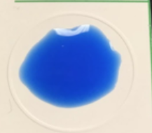 <p><span>The plasma remains <strong>milky, smooth, and fluid</strong>, with no clots or clumping. This indicates other, non-pathogenic Staphylococci.</span> [1, 2, 3, 4, 5]</p>