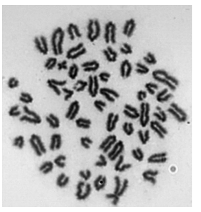 <p>Wskaż chromosomy, w których doszło do pęknięć/złamań chromatynowych.</p>