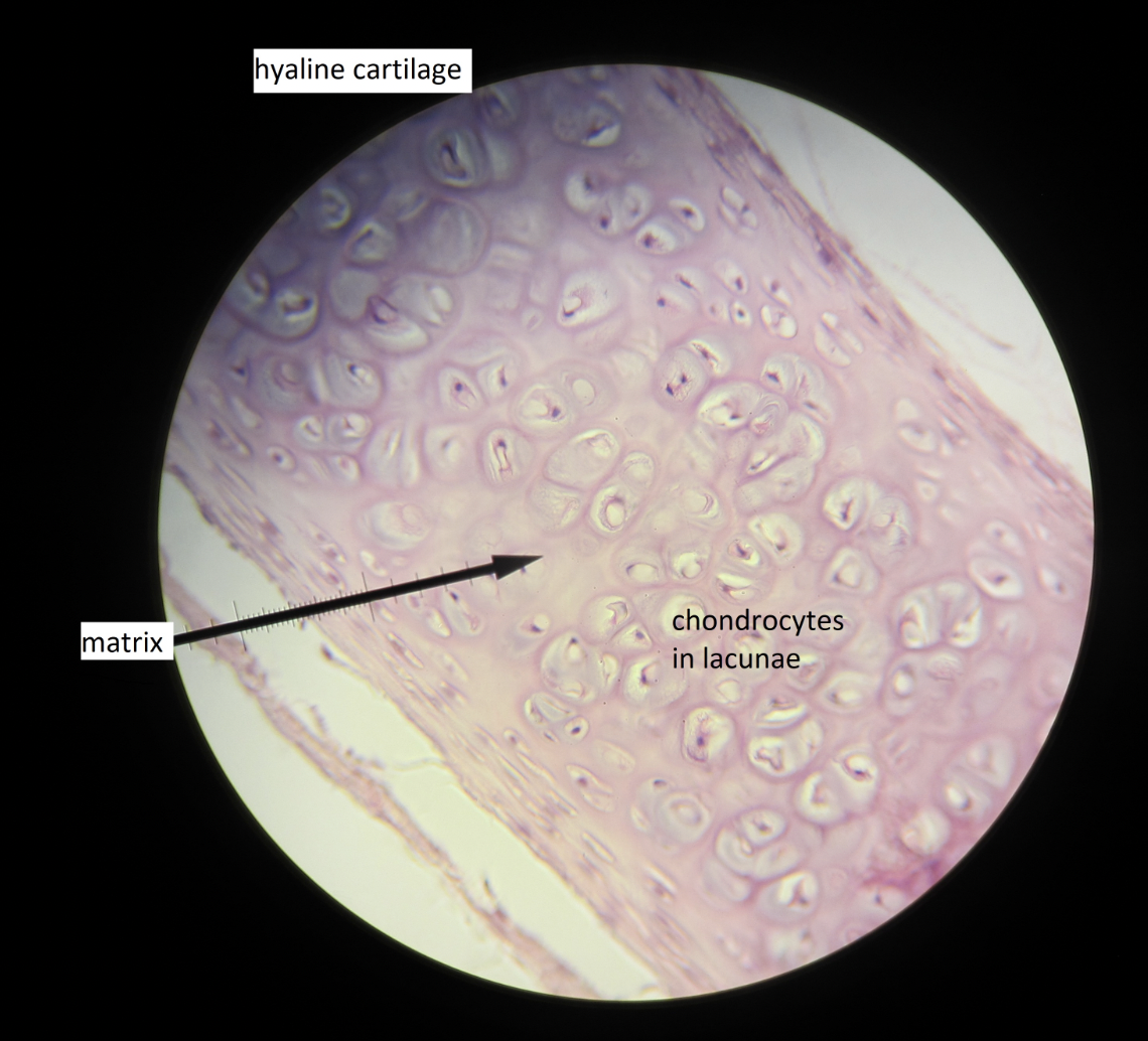 <p>hyaline cartilage, supports and reinforces, ex: embryonic skeleton</p>