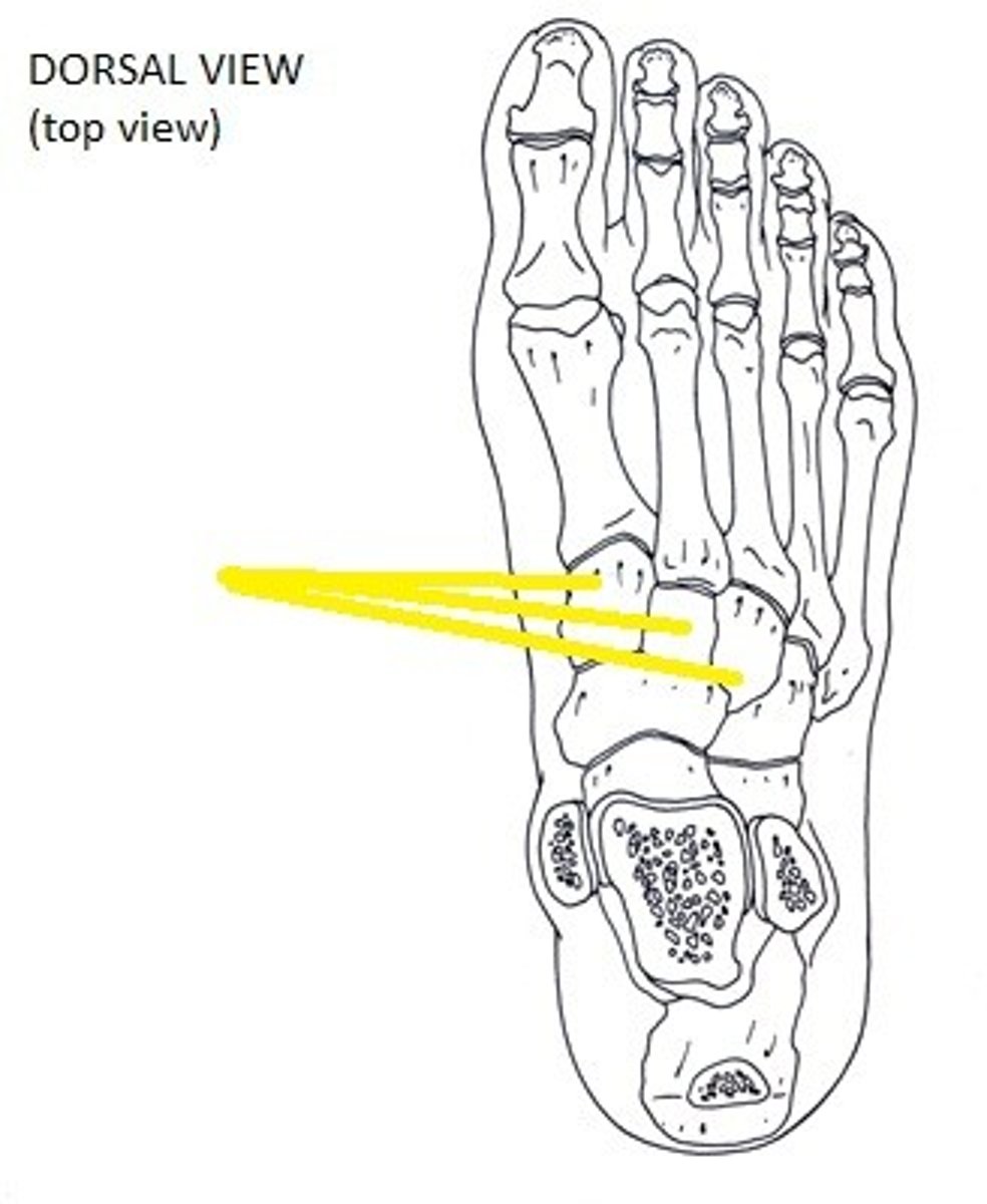 <p>foot</p>