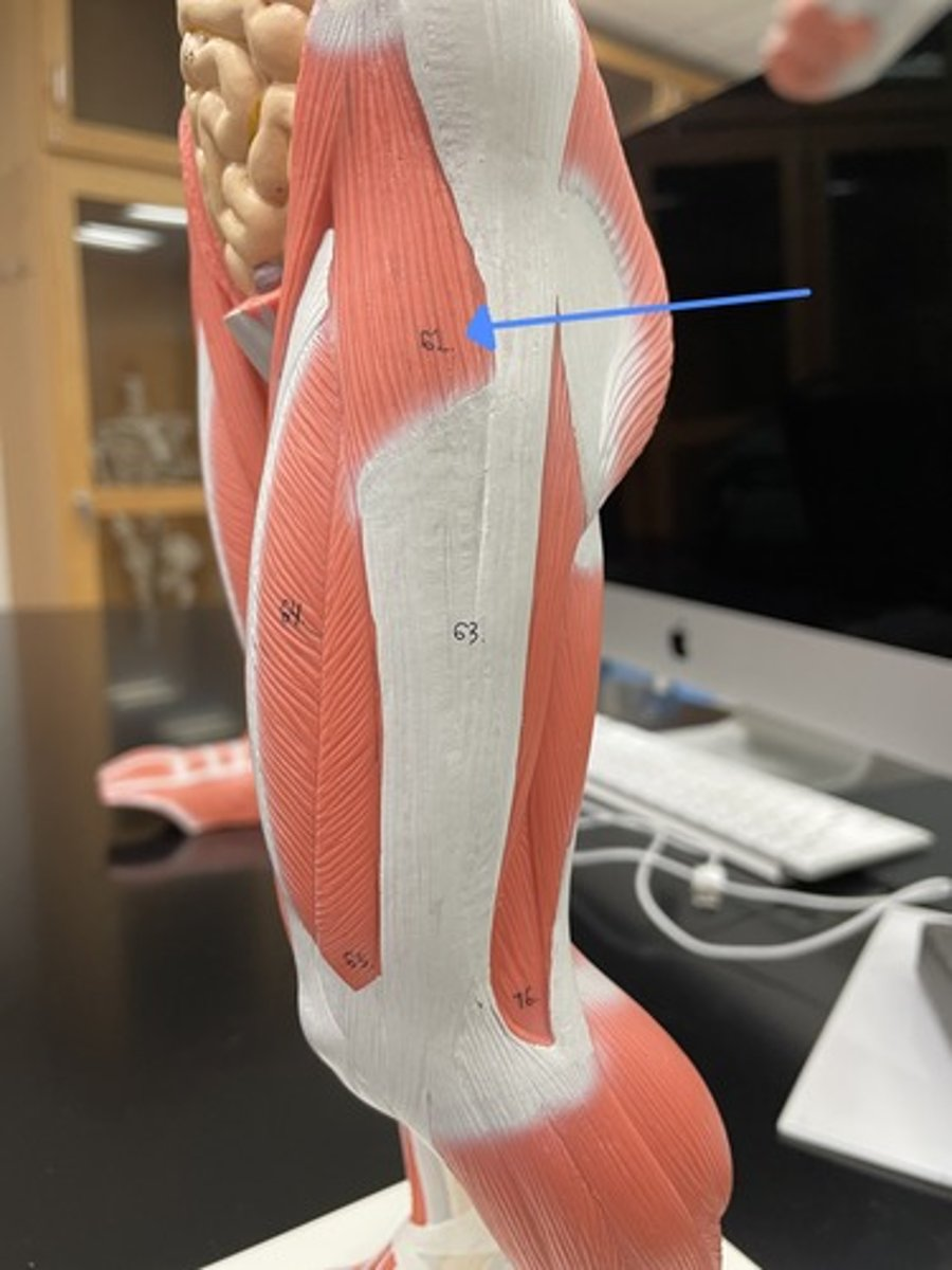 <p>tensor fascia latae </p><p>origin:</p><p>insertion:</p><p>action:</p>
