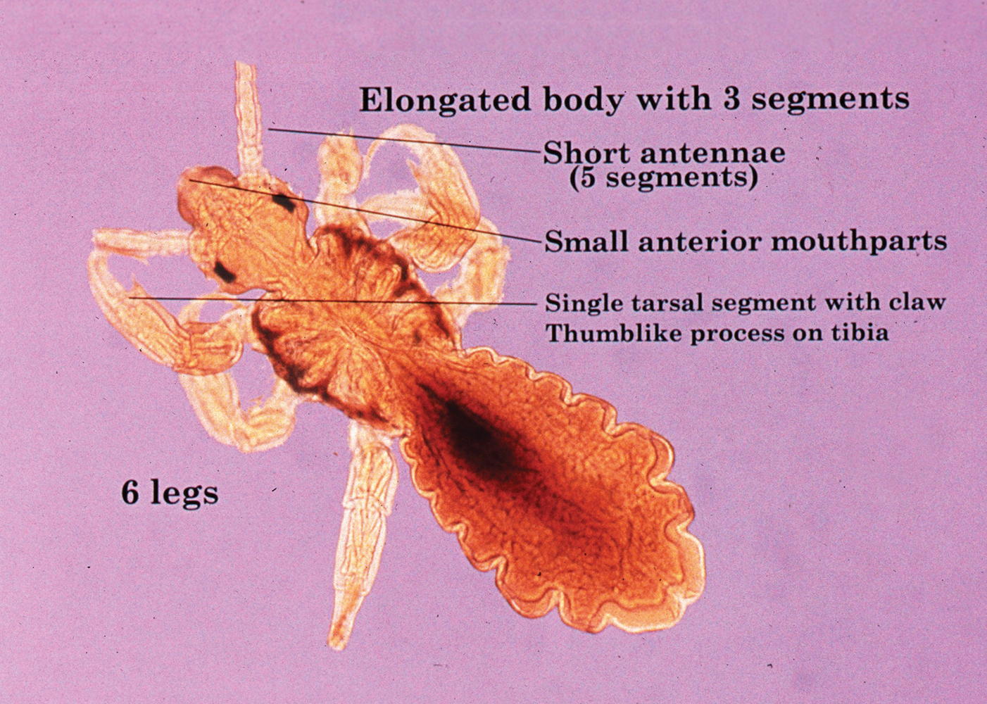 <p>Pediculus humanus humanus (body louse)</p>
