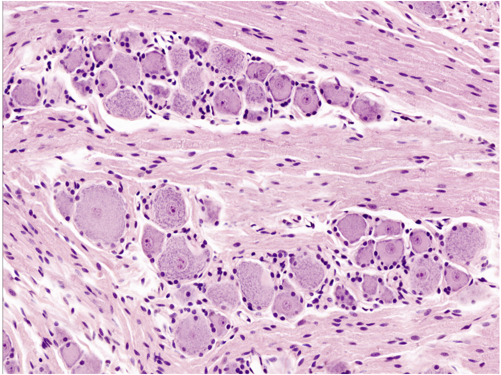 <p>Pseudounipolar</p>