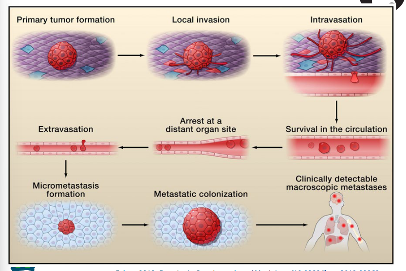 <p>Key words:</p><ul><li><p>Intravasation: Moving into the blood stream</p></li><li><p>Extravasation: </p></li><li><p>Macro-metastasis: Creation of a new tumor</p></li></ul><p></p>
