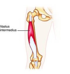 <p>femoral shaft, upper 2/3s</p>
