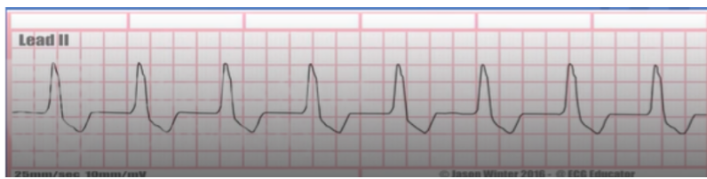 <p>has a faster rate</p>