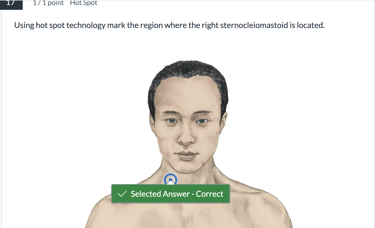 <p><span>Using hot spot technology mark the region where the right sternocleiomastoid is located.</span></p>