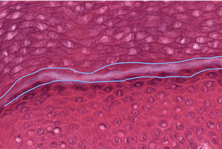 <p>What is layer is circled here?</p>