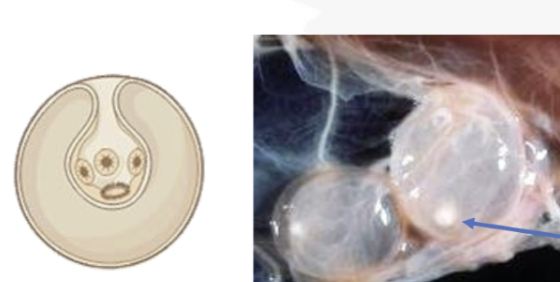 <p>What is this metacestode stage that contains a single inverted scoelx?</p>