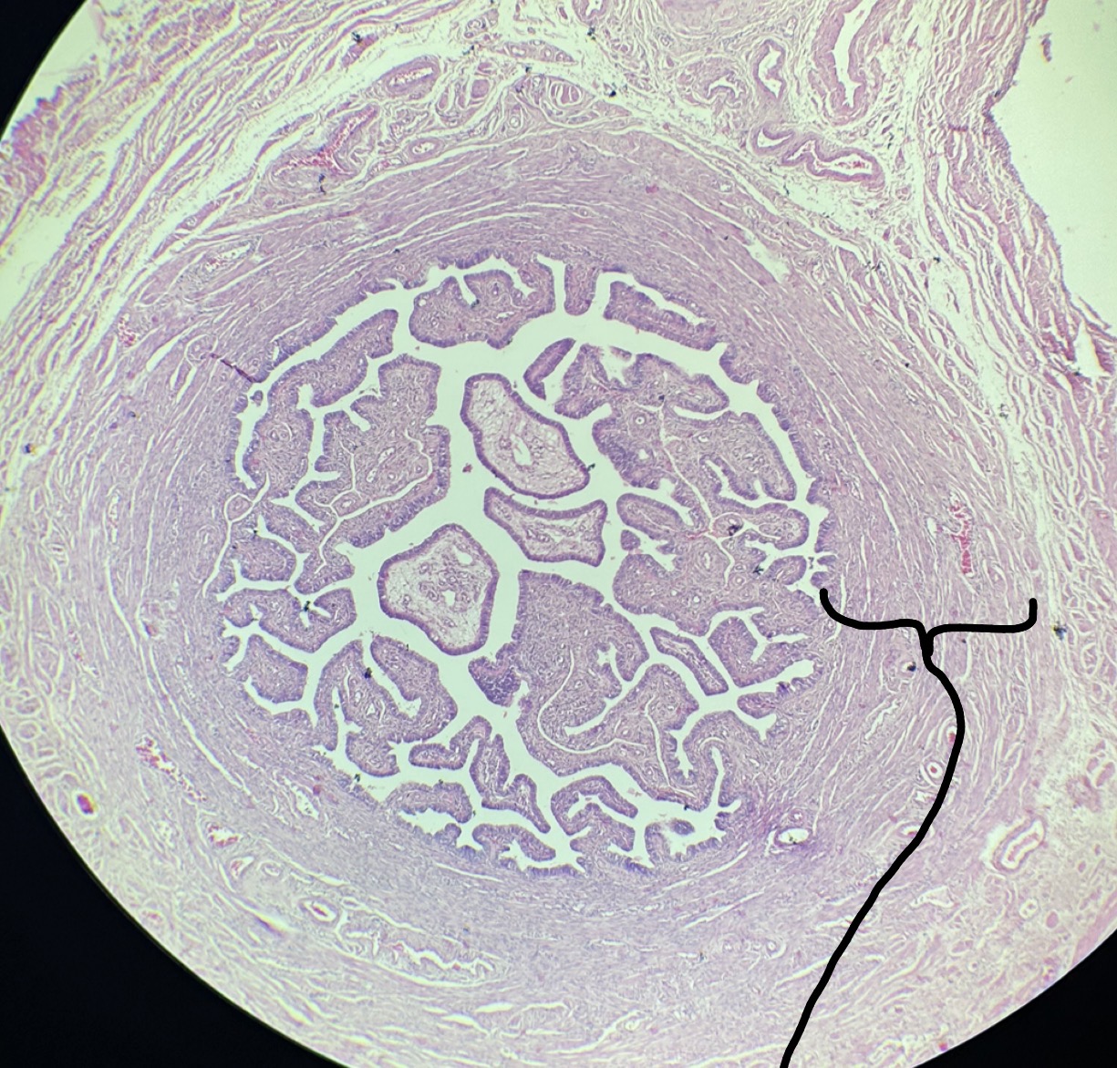 term image