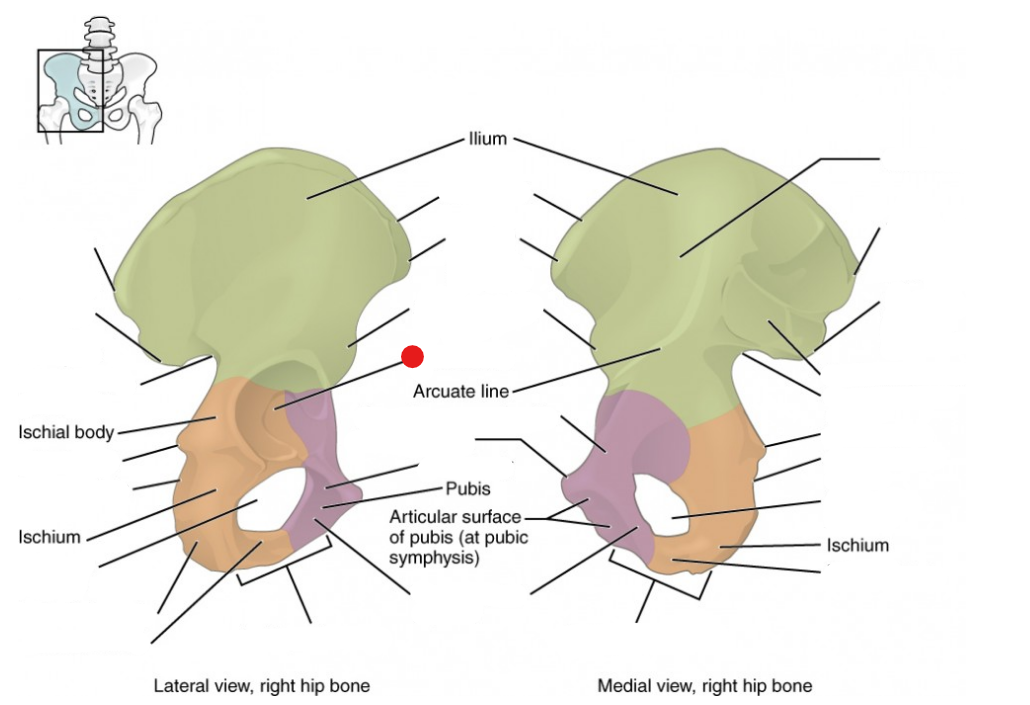 <p>Identify the structure pinned</p>