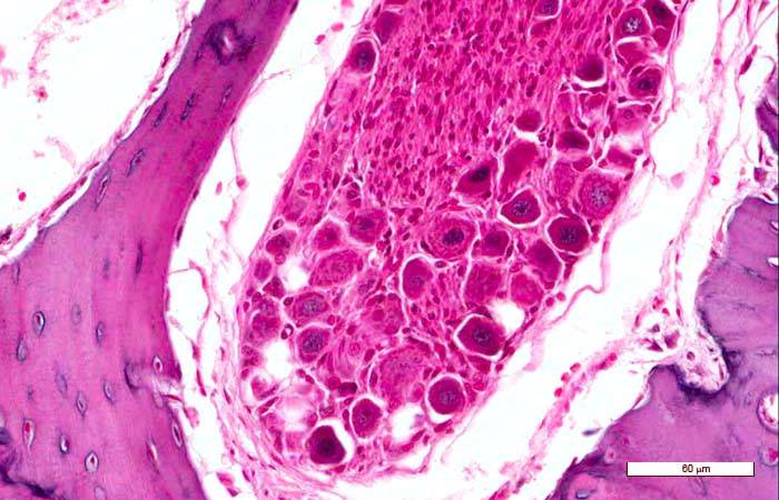 <p>Identifica la plaquita</p>