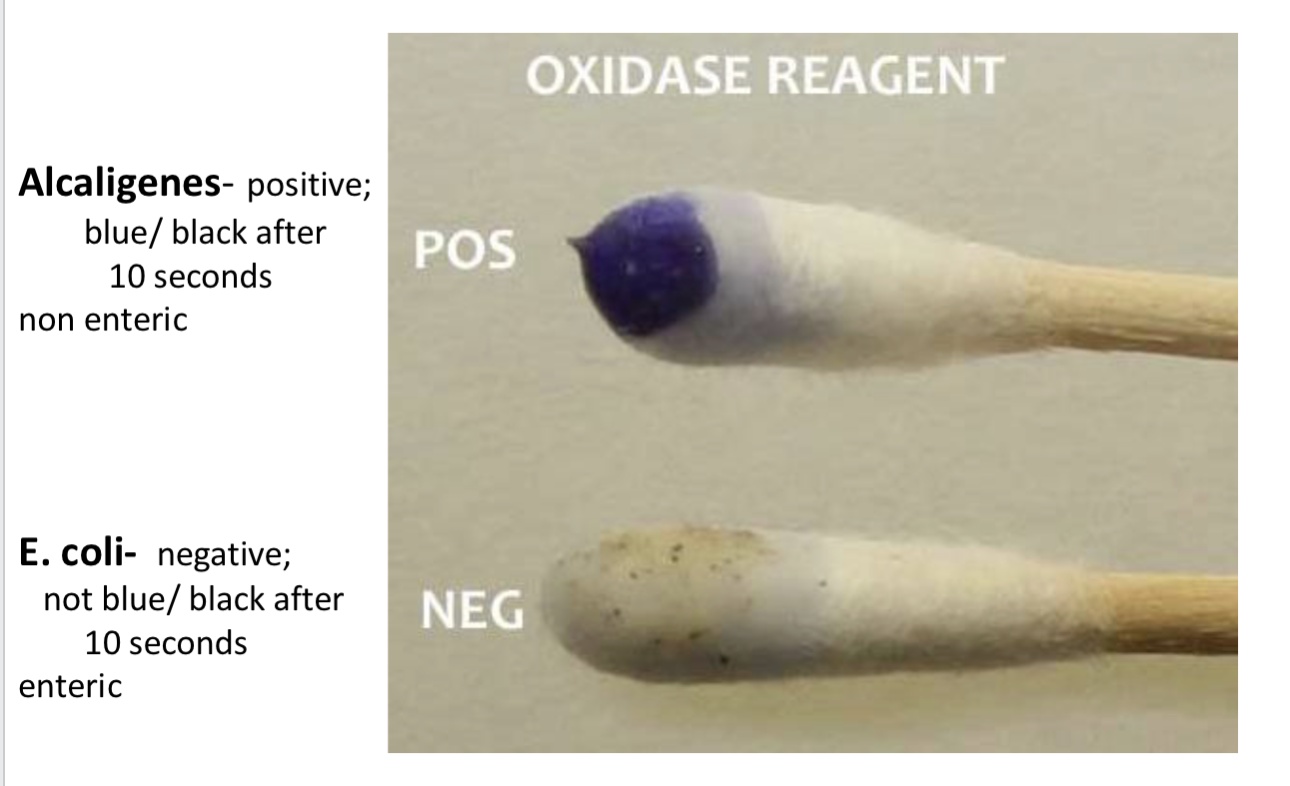 <p><span data-name="fire" data-type="emoji">🔥</span> WHY THIS TEST MATTERS </p><p>OXIDASE test</p>