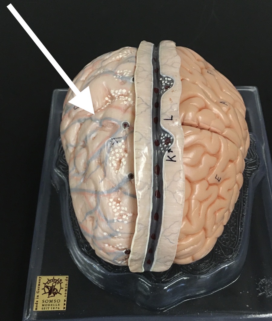 <p>What is the white layer the arrow is pointing to?</p>