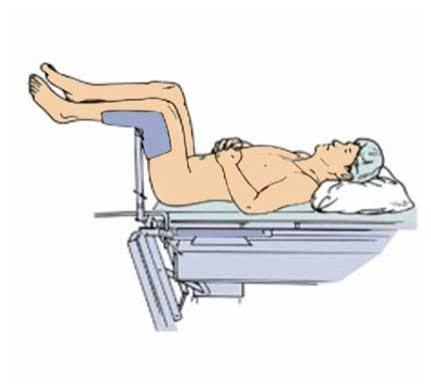 <p><span>When preparing for a Pap smear, the medical assistant should position the patient in:</span></p>
