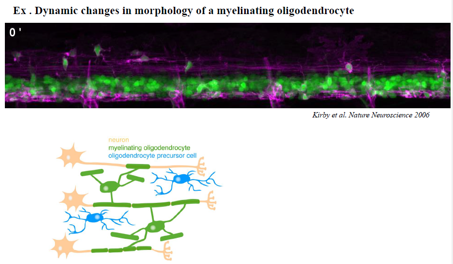 <p>Under modning ændrer oligodendrocytter form dramatisk for at kunne danne myelin omkring axoner.</p><p>Figurerne viser:</p><ul><li><p>process extension og branching</p></li><li><p>overgang fra simple til komplekse lamellare strukturer</p></li><li><p>reorganisering af aktin under differentiering</p></li></ul><p>Aktinpolymerisering er nødvendig i de tidlige stadier for udvækst og branching.</p>