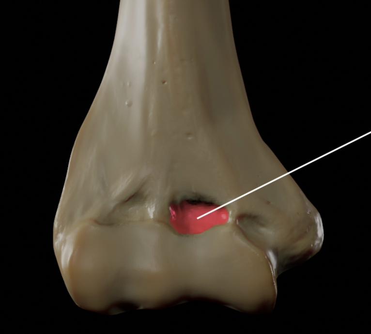 <p>Receives coronoid process of ulna. <strong>(Humerus)</strong></p>