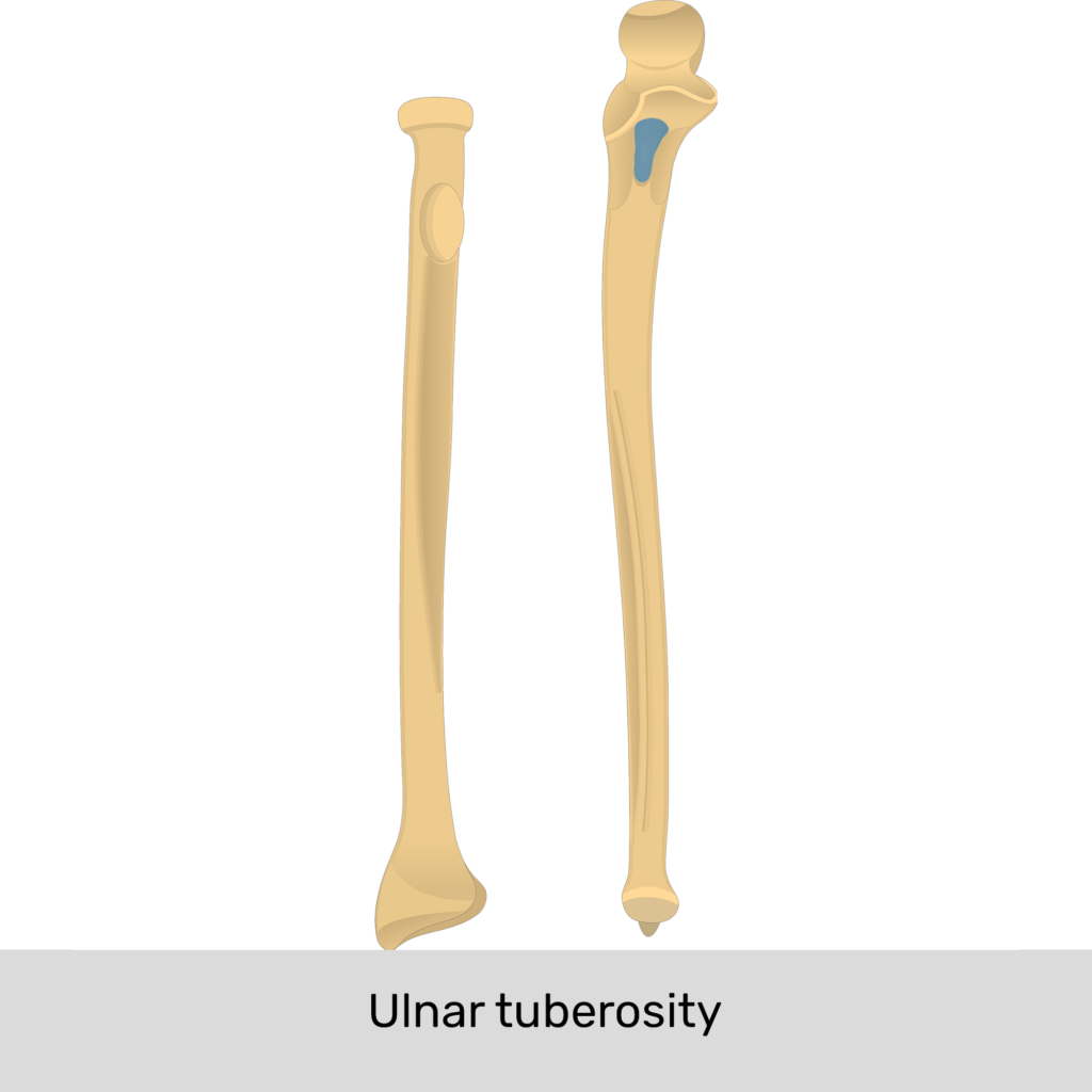<p>Ulnar Tuberosity</p>