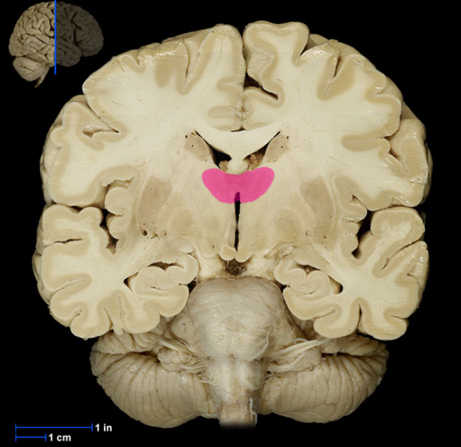 <p>Relay station / gateway to cerebral cortex</p><p>sorts, edits, and relays all afferent (sensory) impulses from senses</p><p>organizes which part of the cortex information goes to </p>