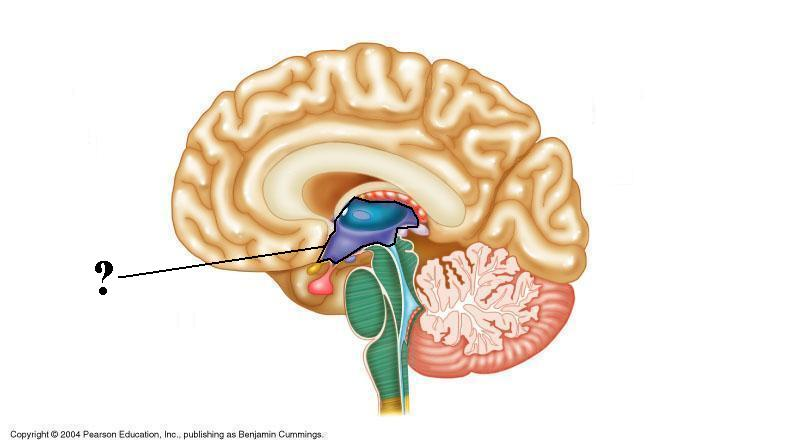 <p>Identify the indicated space of the brain</p>