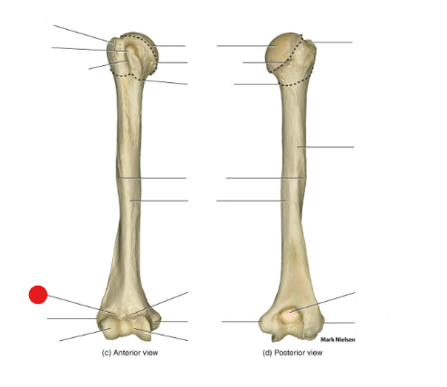 <p>Identify the structure pinned</p>