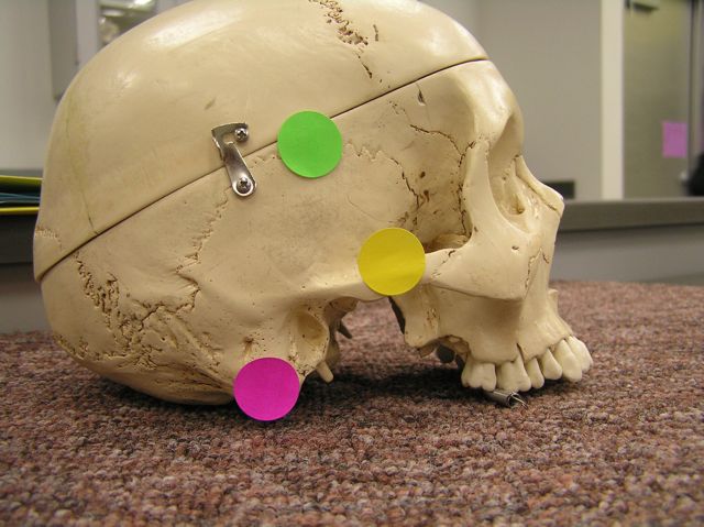 <p><span>Identify the structure labeled with the pink dot AND name the bone it is part of.</span></p>