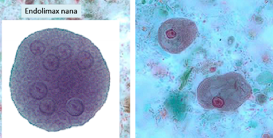 <p>Cyst: 8+ nuclei</p><p>Tropozoite: 1 nucleus with large/dirty cytoplasm</p>
